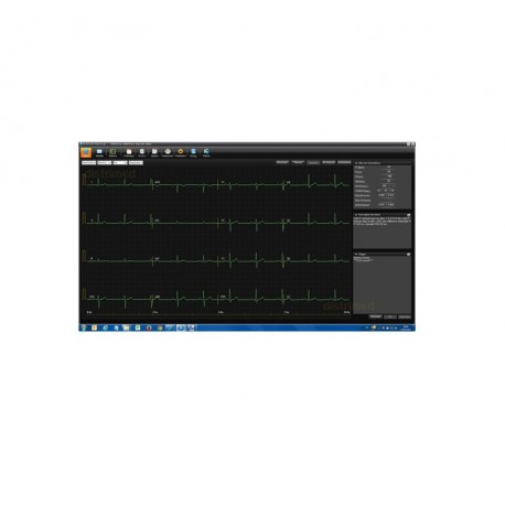 Se-1010 PC-EKG-system with interpretation