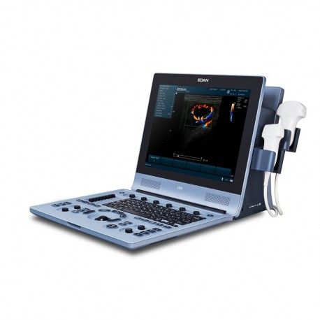 U60 Edan Ultralydsscanner m. colordoppler